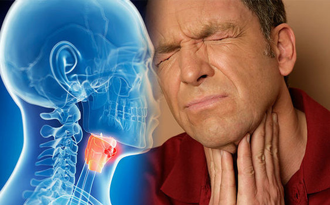 12 dấu hiệu quan trọng cảnh báo ung thư vòm họng
