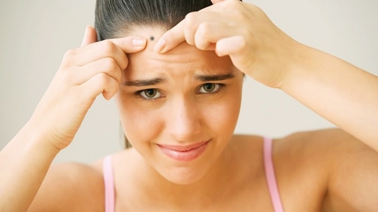 Tự tẩy nốt ruồi: nguy hiểm