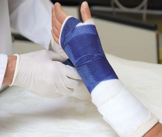 Biến chứng và di chứng dễ gặp sau gãy xương