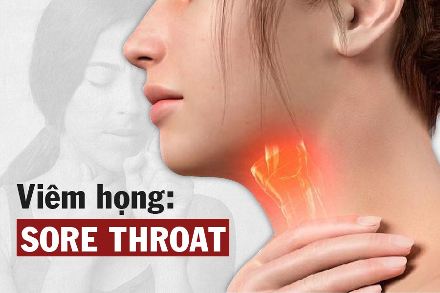 Viêm họng và kháng sinh