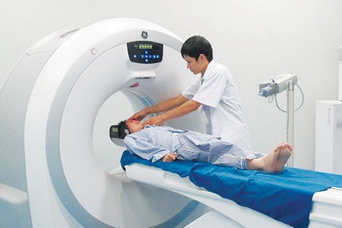 Triệu chứng của cơn đau đầu RẤT NGUY HIỂM không được chủ quan