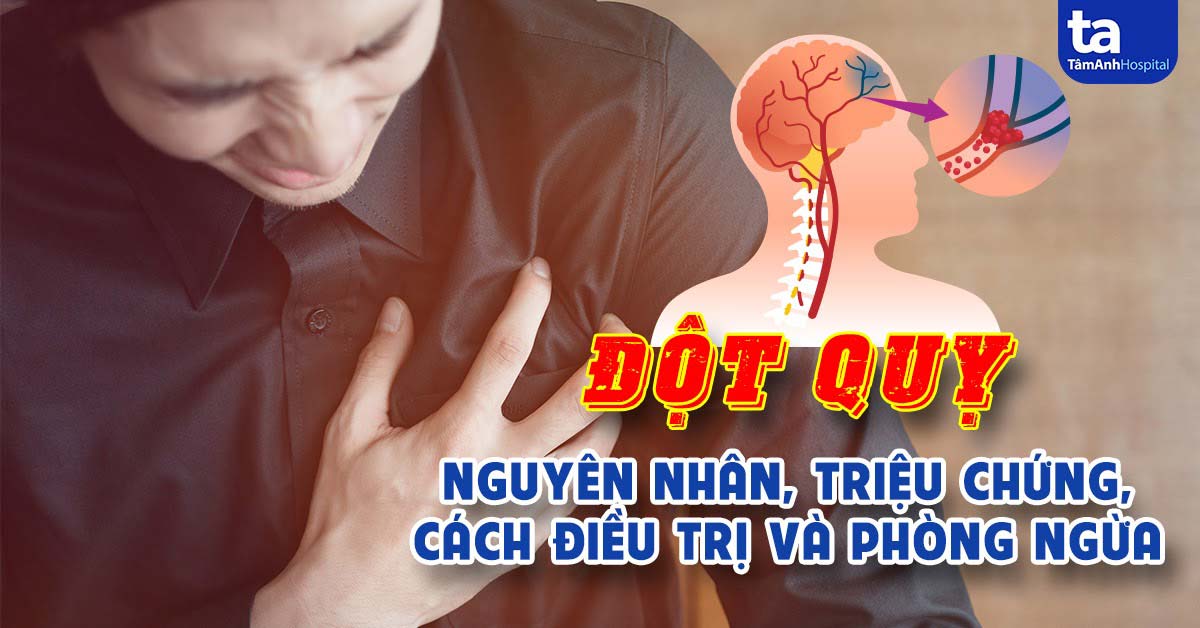 Đột quỵ cần xử lý tức thời ra sao?