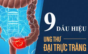 Nhiều người ung thư đại trực tràng phát hiện trễ