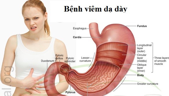 Loét Dạ Dày và Các Triệu Chứng Nguy Hiểm